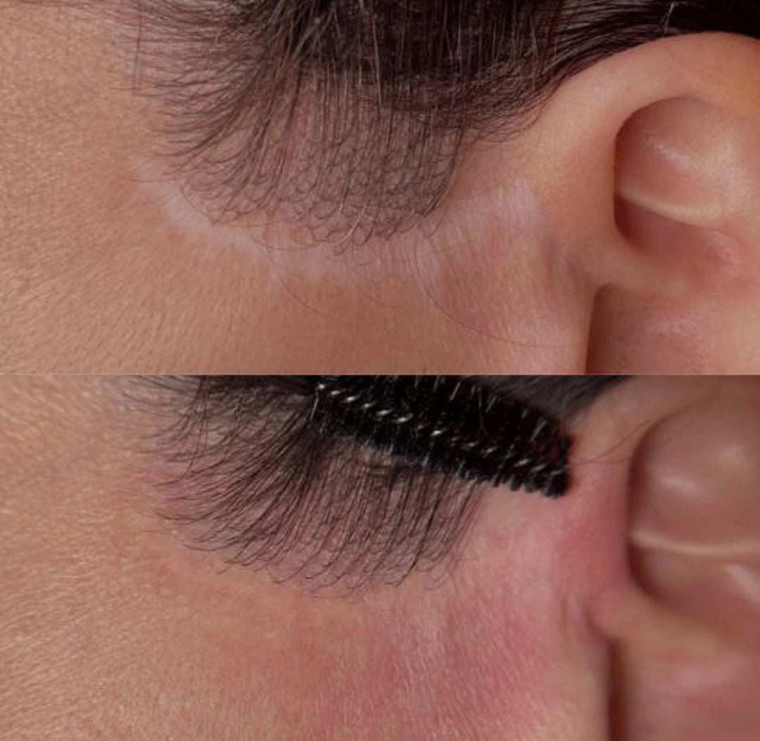 Before and after: a pale facelift scar in front of the ear blended with camouflage pigment
