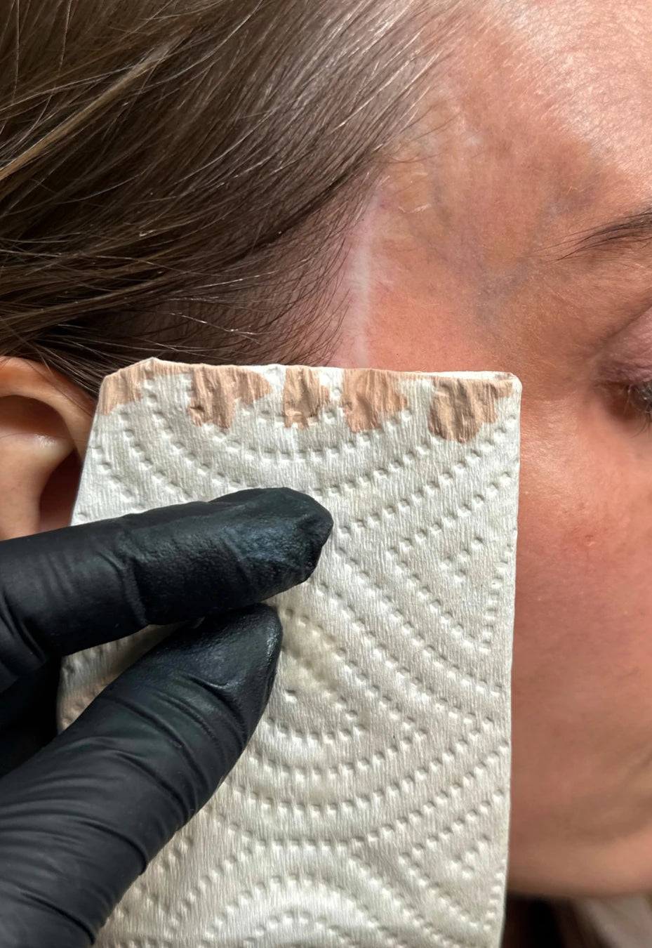 Custom-mixed pigment swatches tested against the skin beside a scar at the temple, to match the colour