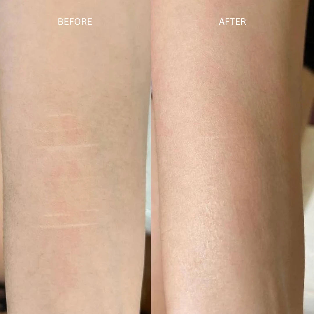 Before and after: pale self-harm scars on the forearm softened and blended