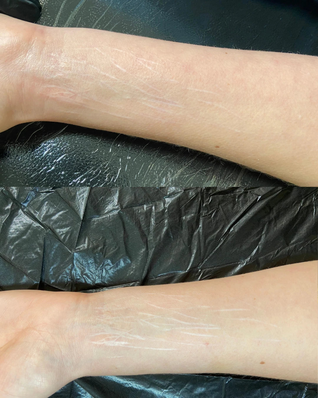 Before and after: white self-harm scars on the inner wrist softened and blended